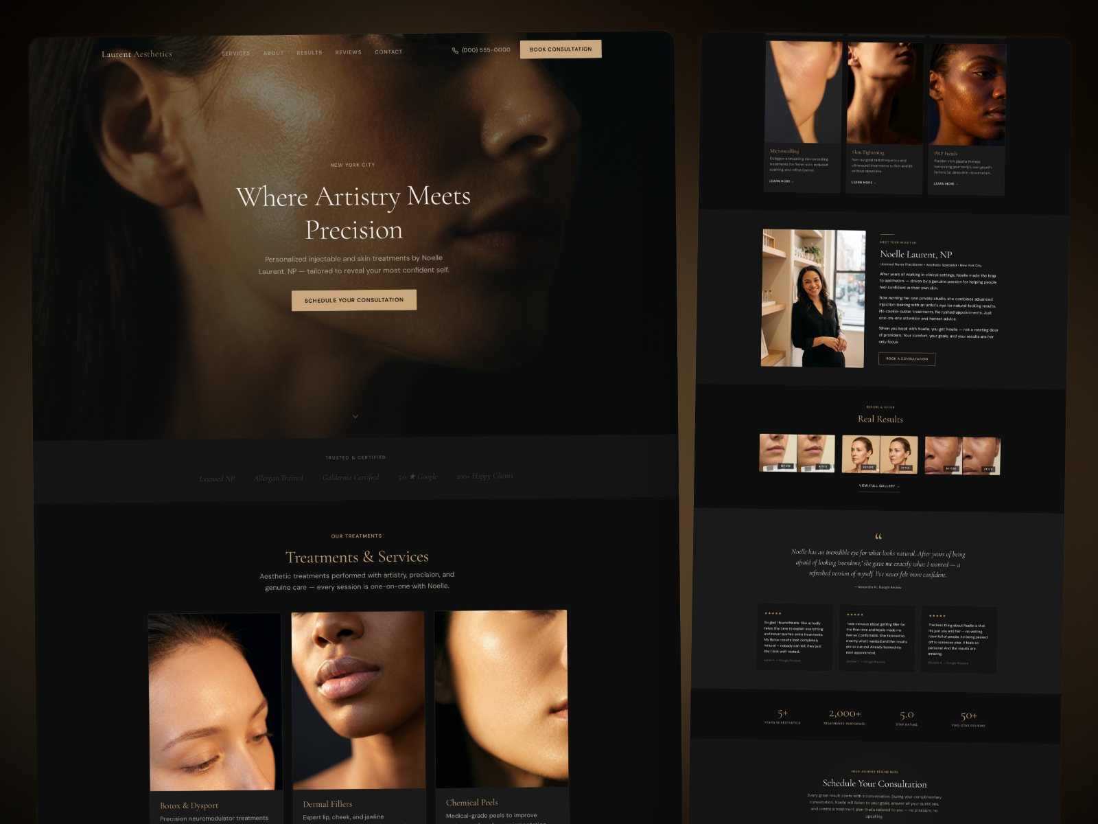 Laurent Aesthetics concept site, dark luxury palette with champagne gold